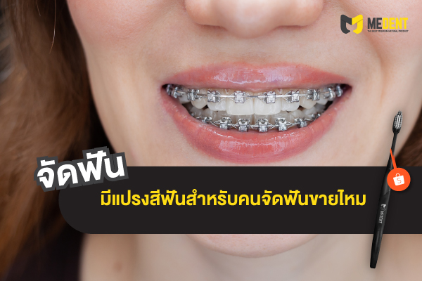 จัดฟันใช้แปรงไฟฟ้าได้ไหม