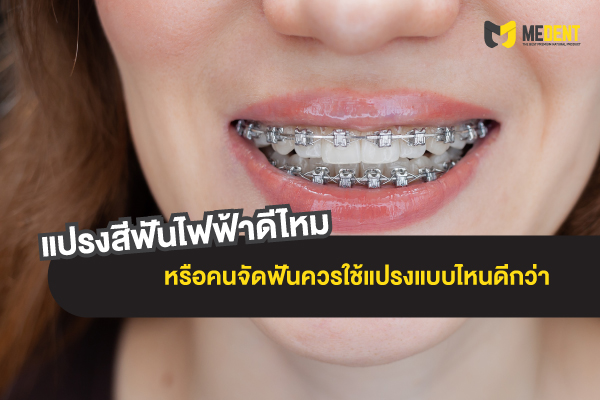 จัดฟันใช้แปรงไฟฟ้าได้ไหม