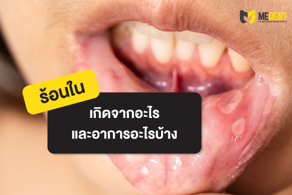 ยาสีฟันมีเด้นท์ [Medent] ผลิตภัณฑ์ดูแลช่องปากลดกลิ่นปากฟันขาวมั่นใจ